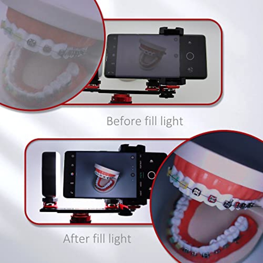 Bluetooth Dental Flash Light P - đánh giá và giá Photography Equipment