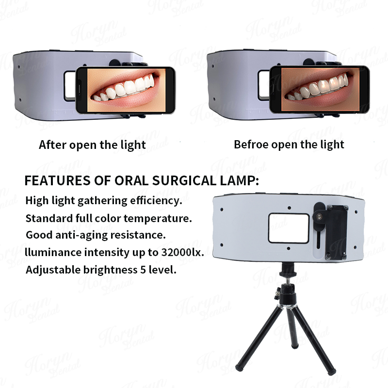 Dental Flash Light Photography - đánh giá và giá Photography Equipment